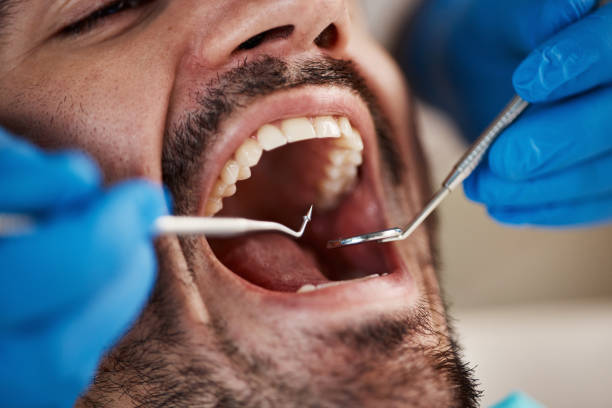 Best Emergency Wisdom Teeth Removal in Nesquehoning, PA